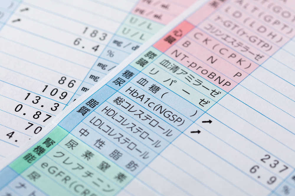 おすすめの健診予約システムならデータセレクト